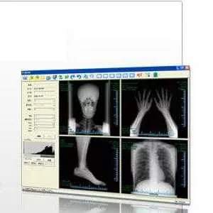 Цифровой приемник рентгенграфического изображения